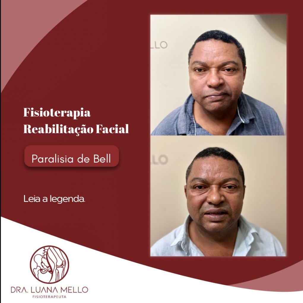 Material da Dra. Luana Mello sobre reabilitação facial e paralisia de Bell, com dois registros de acompanhamento.
